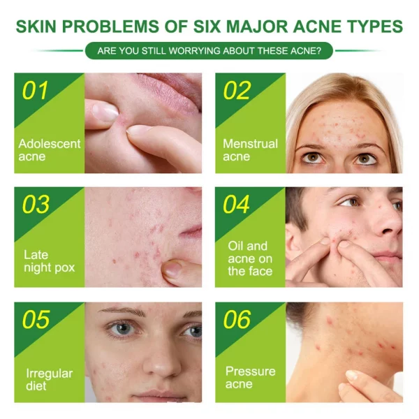 Acne Patches - Image 2