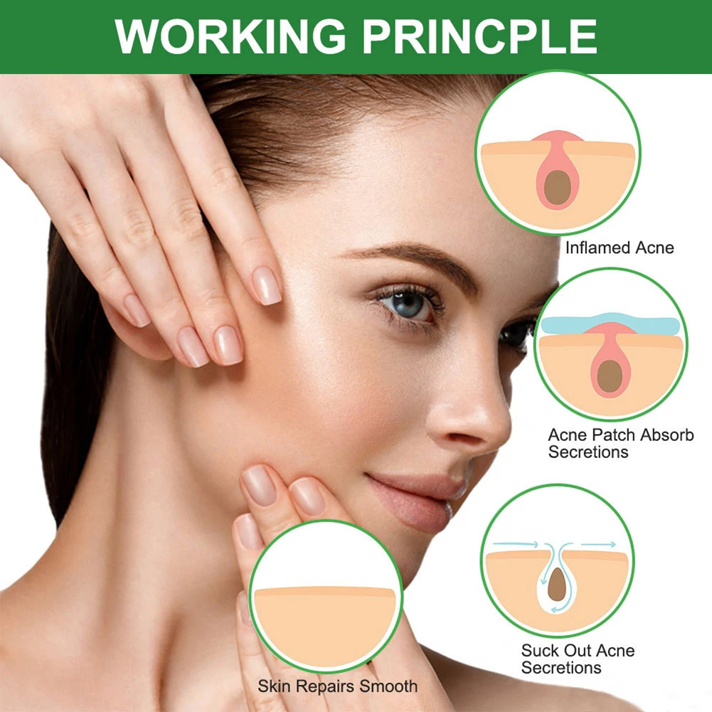Acne Patches