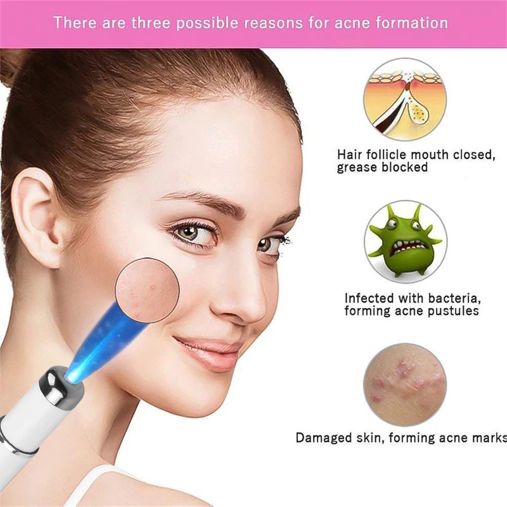 Blemish Removal Laser Pen