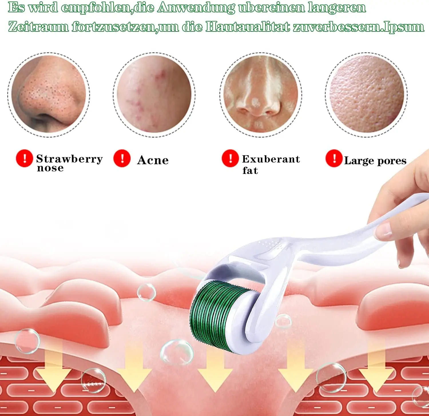 Microneedle Roller