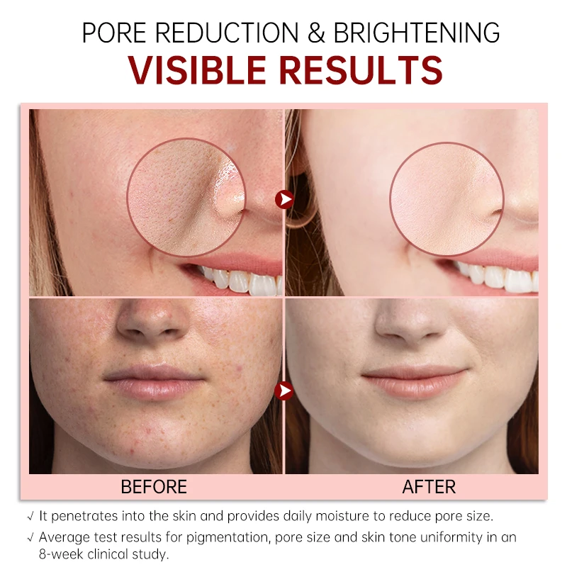JoyPretty Skin Care Set