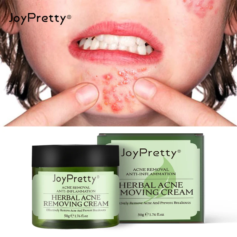 JoyPretty Facial Skin Care Sets Acne Treatment Cream & Serum