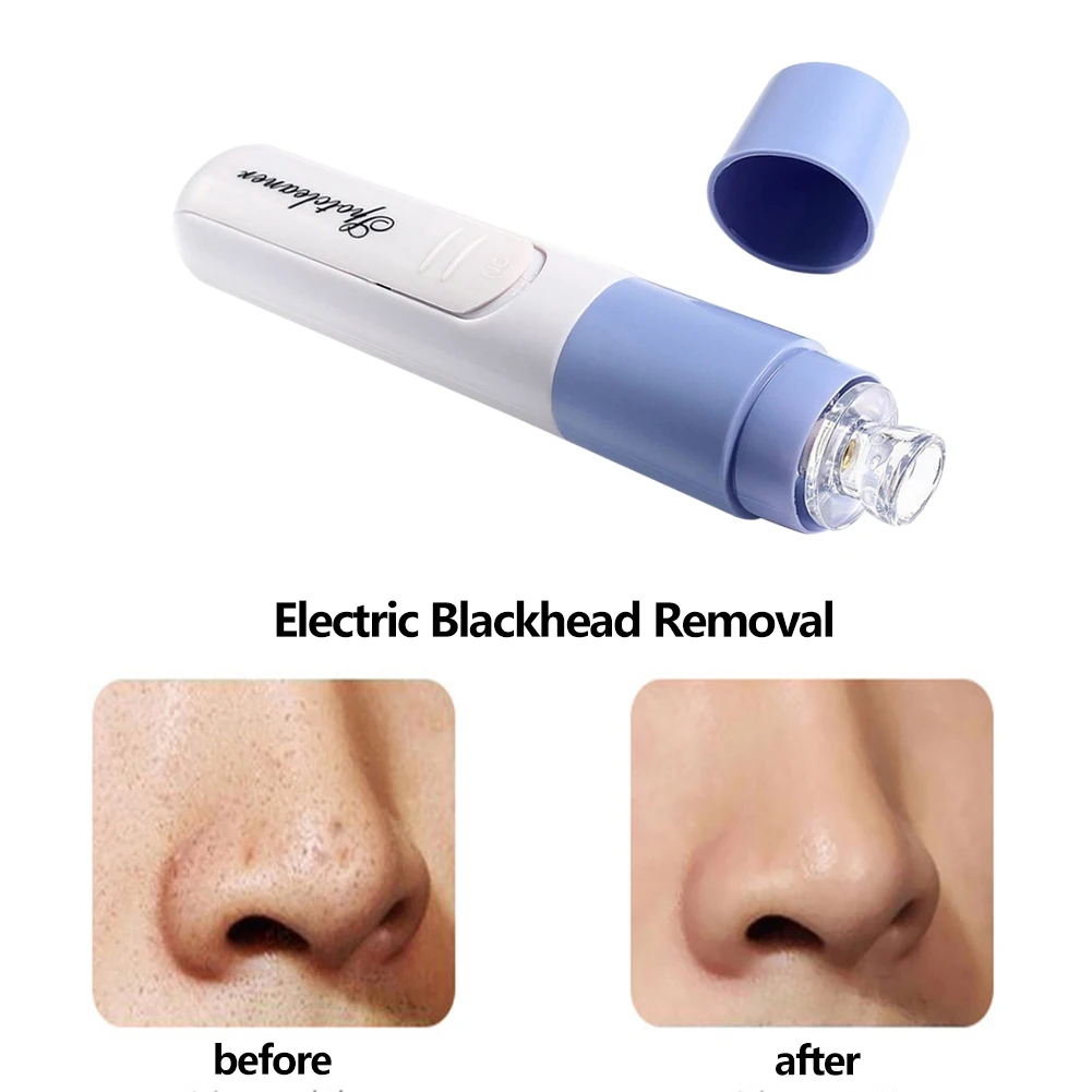 Blackhead Remover Vacuum